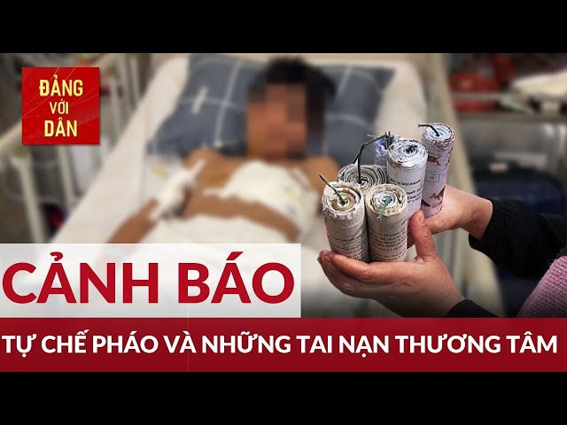 Bốn học sinh bỏng nặng khi chế pháo nổ